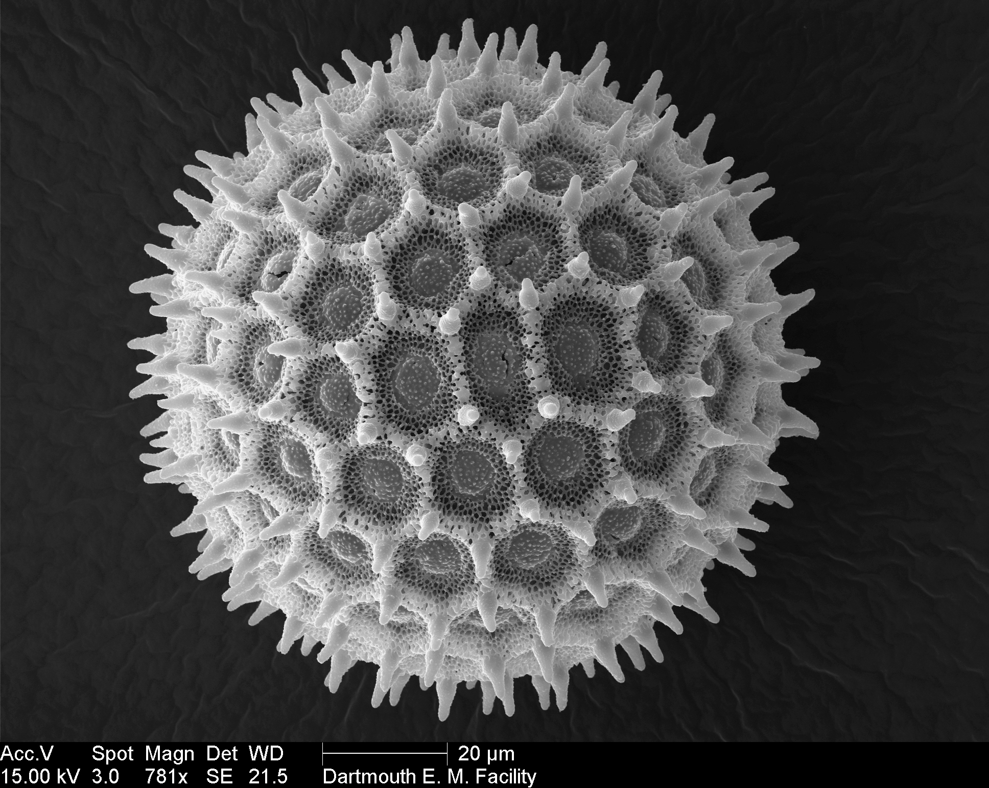 Вирус гриппа под. Вирус коронавирус микроскоп. Вирус коронавирус под микроскопом. Коронавирус микрофотография. Коронавирус в микроскопе.